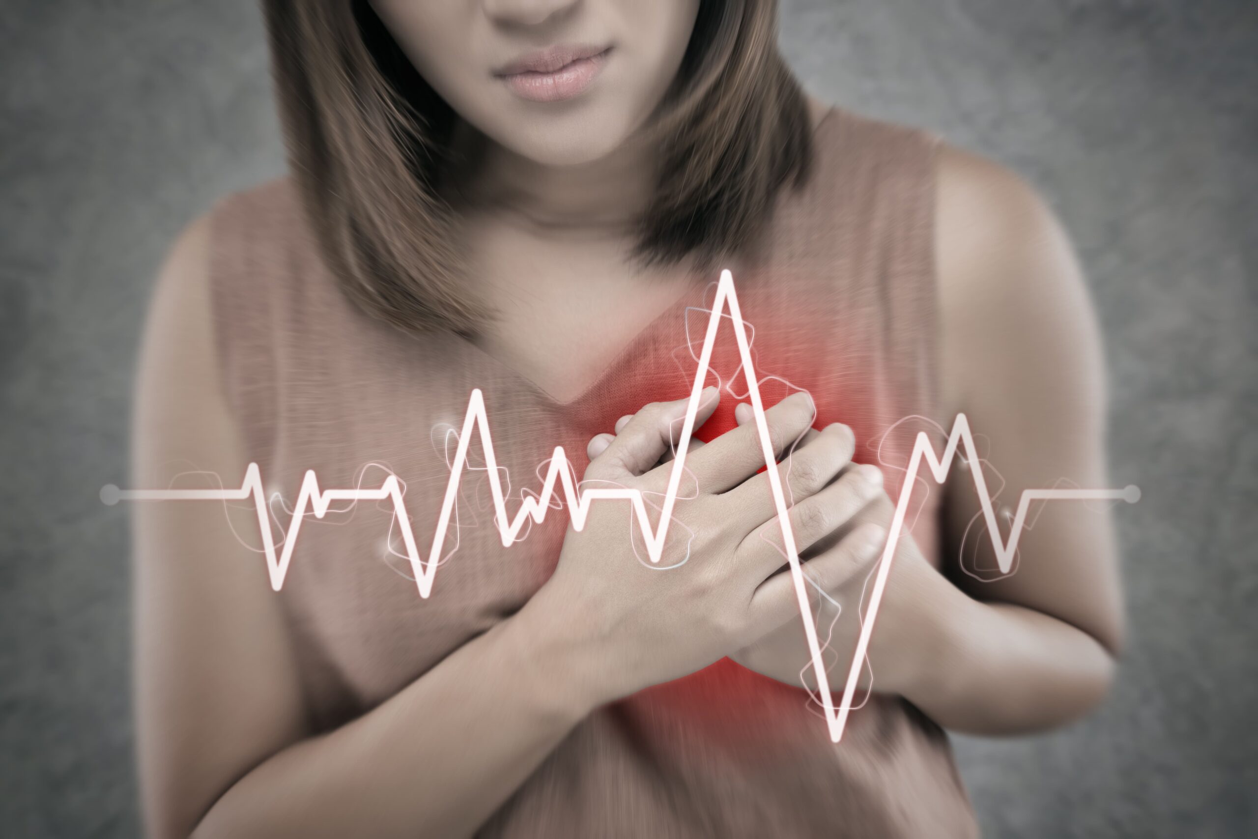Síntomas de un infarto en mujeres